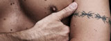 Tattoo-Entfernung